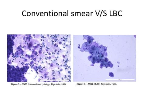 predominance of coccobacilli consistent with shift in flora|Predominance Of Coccobacilli Consistent With Shift In Vaginal .